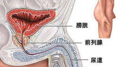 男性支原体-泉州男科医院
